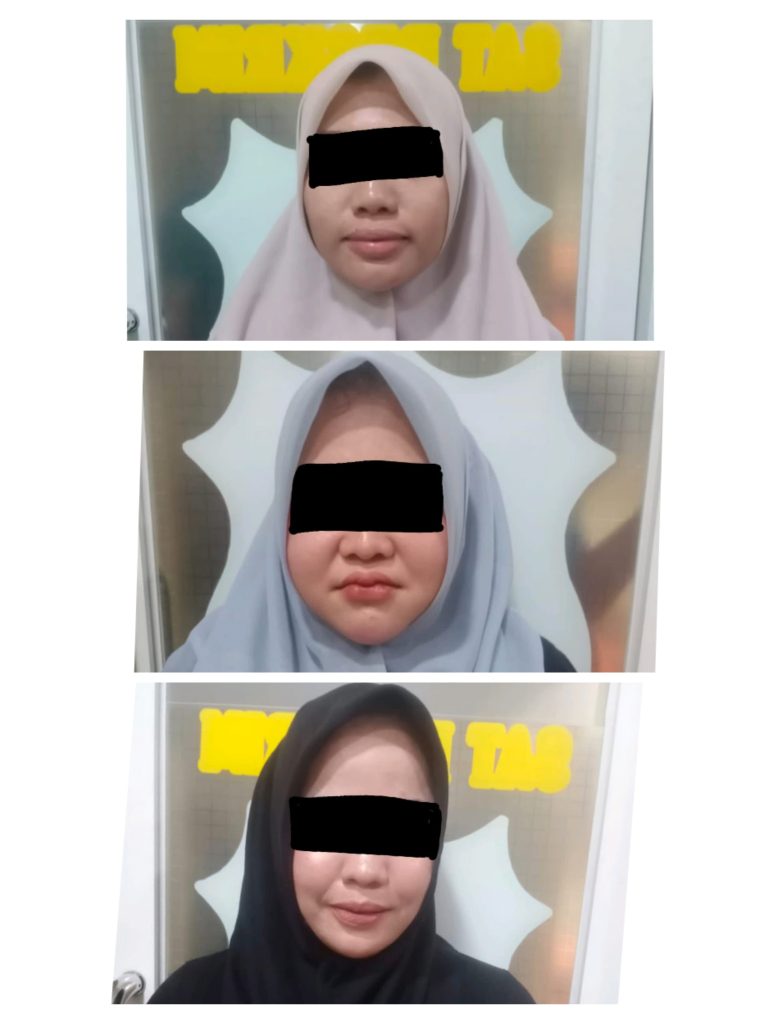 Satreskrim Polresta Banda Aceh Kembali Ungkap Kasus Prostitusi Online