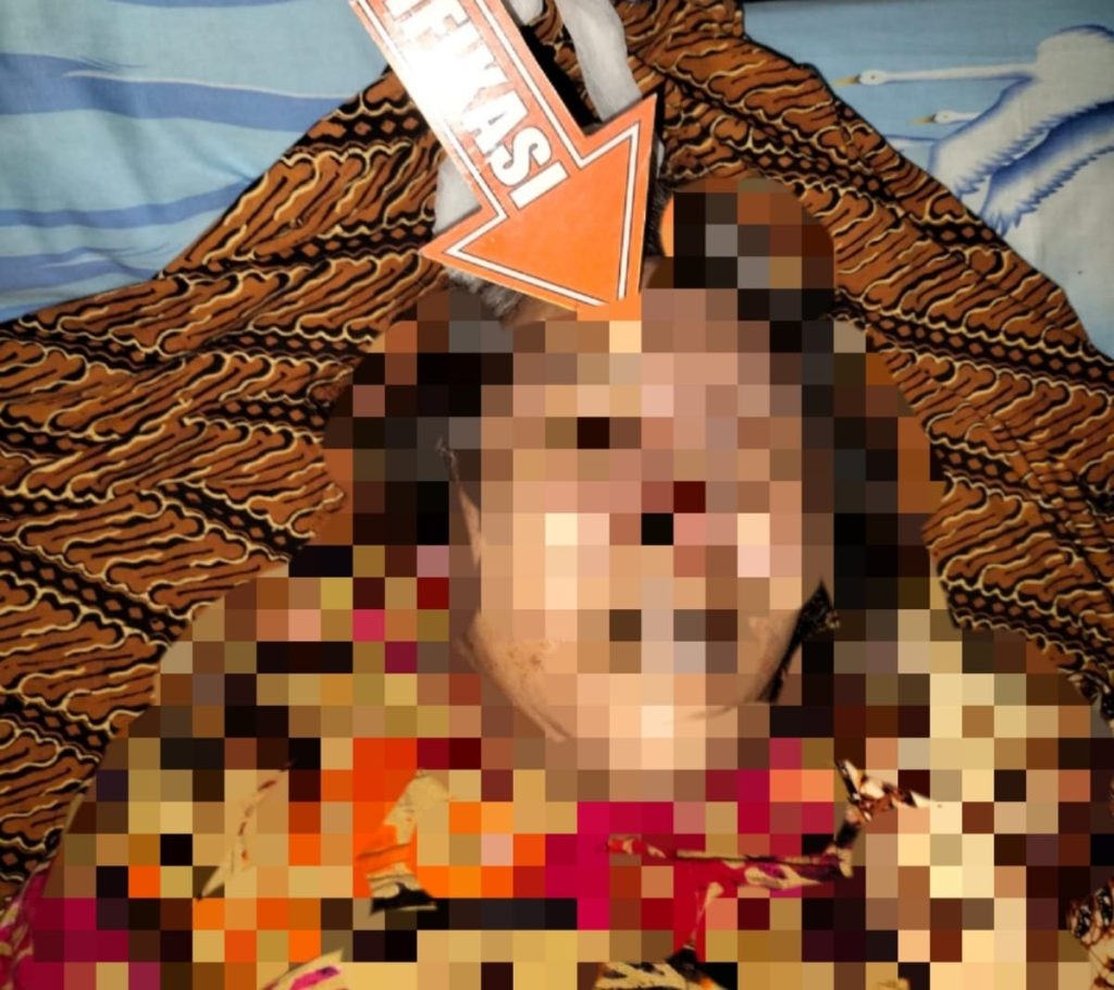 Diduga Dianiaya Sampai Meninggal Dunia, Polisi Olah TKP Penemuan Mayat Istri Dokter di Ruko Praktek